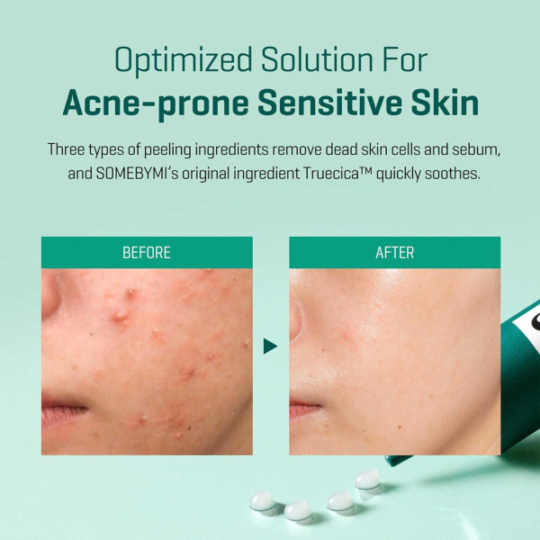 skincare-kbeauty-glowtime-some by mi aha bha pha miracle spot cream