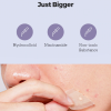skincare-kbeauty-glowtime-cosrx master pimple patch x large
