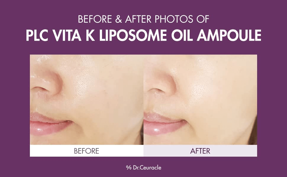 skincare-kbeauty-glowtime-dr ceuracle vita k liposomes oil ampoule