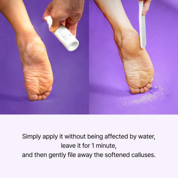 skincare-kbeauty-glowtime-baren callus remover foot spray