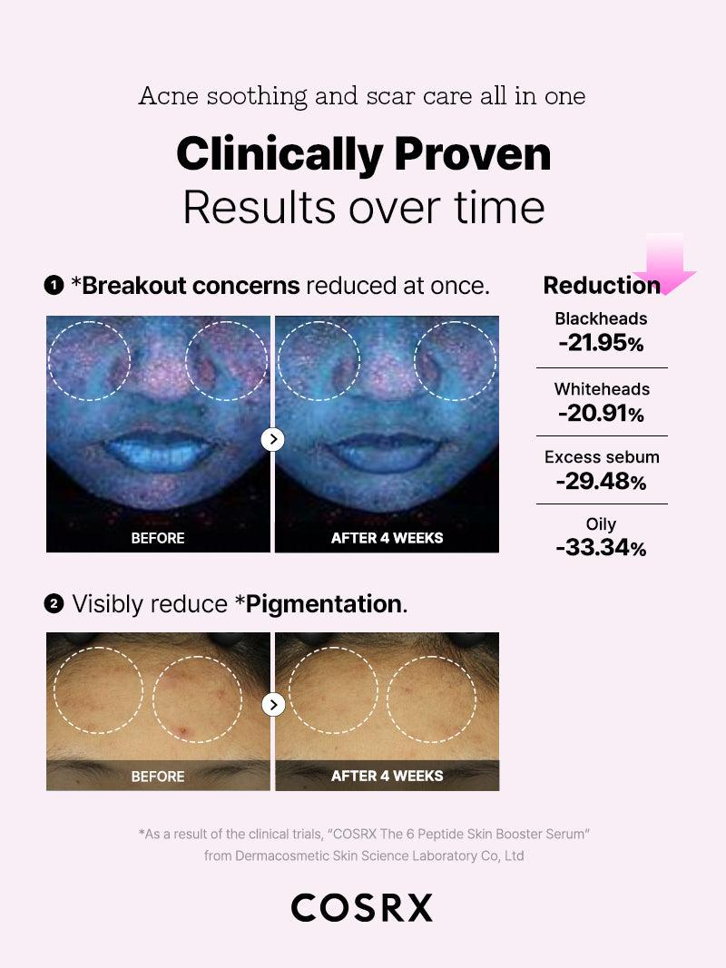 The6_Peptid_Serum_6 skincare-kbeauty-glowtime-cosrx the 6 peptide booster serum