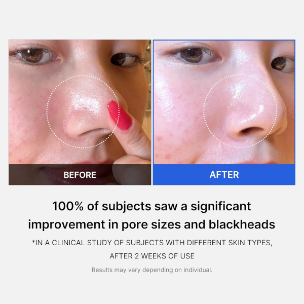 skincare-kbeauty-glowtime-medicube zero pore pad 2.0