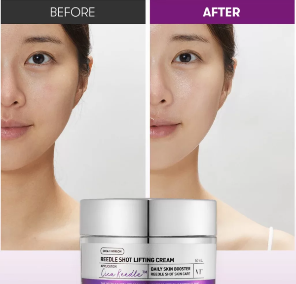 skincare-kbeauty-glowtime-vt cosmetics reedle shot lifting cream