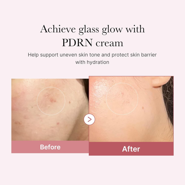 skincare-kbeauty-glowtime-medidube pdrn pink hyaluronic moisturizing cream