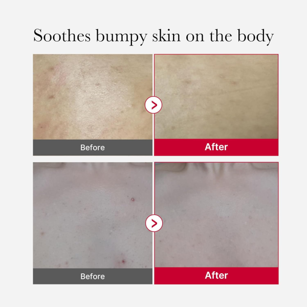 skincare-kbeauty-glowtime-medicube red body peeling shot