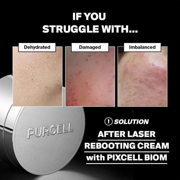 skincare-kbeauty-glowtime-purcell pixcell biom after rebooting craem