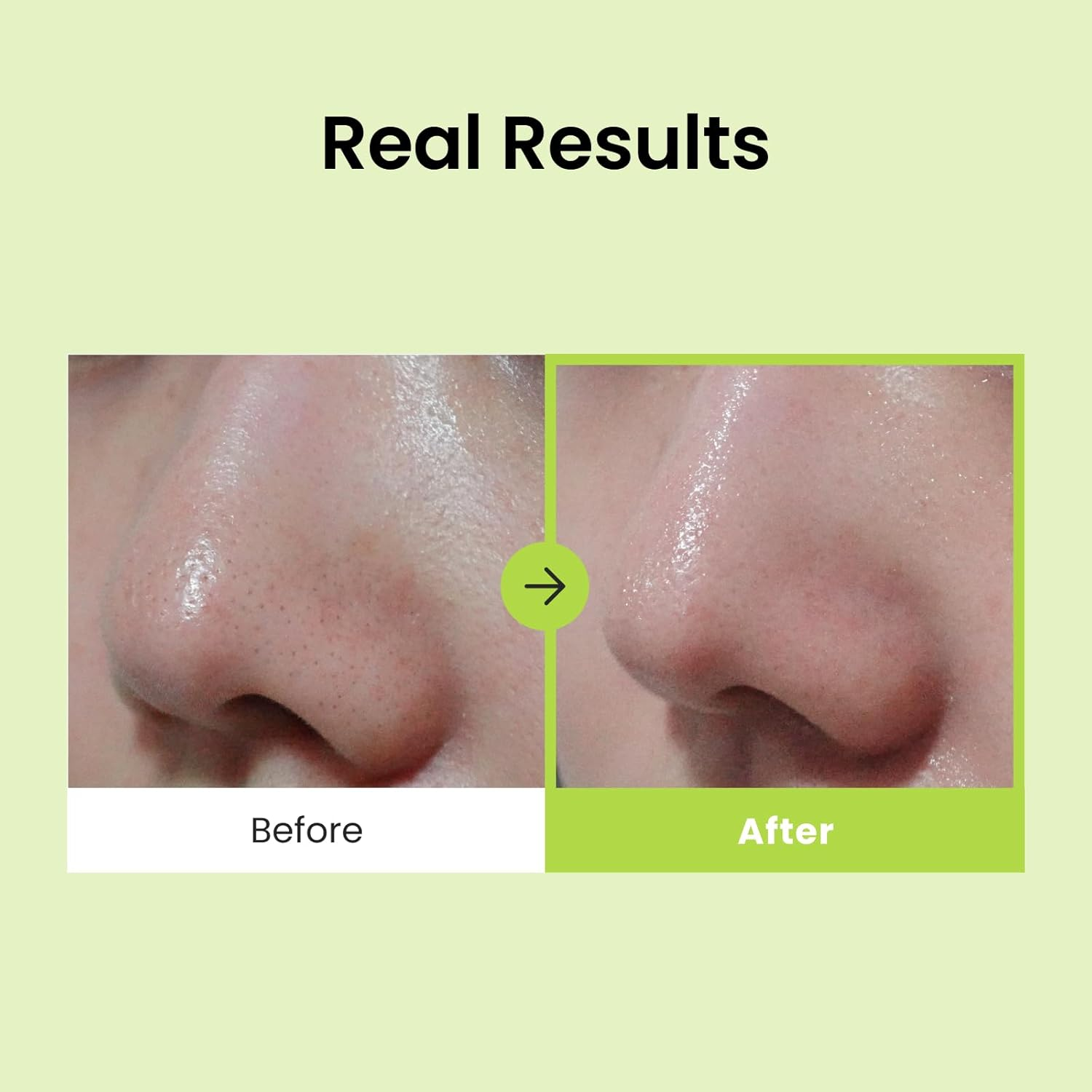 =skincare-kbeauty-glowtime-cnp skincare-kbeauty-glowtime-cnp laboratory pore and blackhead clear kit