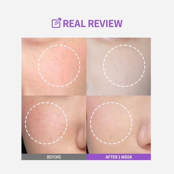 skincare-kbeauty-glowtime-sungboon editor meoru podo vita c dark spot ampoule