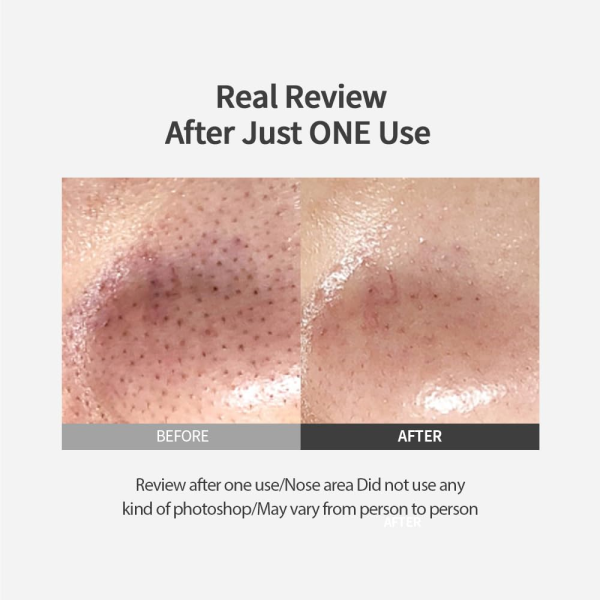 skincare-kbeauty-glowtime-sungboon editor blackhead melting clear pad