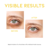 skincare-kbeauty-glowtime-ootd beauty dark circle eye serum