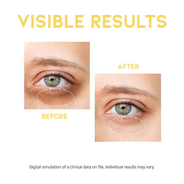 skincare-kbeauty-glowtime-ootd beauty dark circle eye serum
