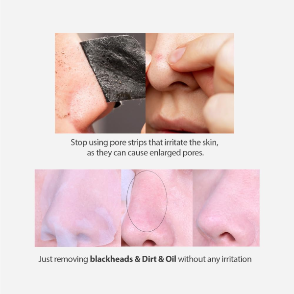 skincare-kbeauty-glowtime-sungboon editor blackhead melting clear pad