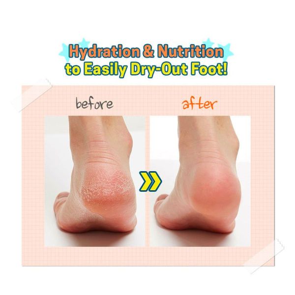 skincare-kbeauty-glowtime-apieu soft foot 30 minute peeling socks