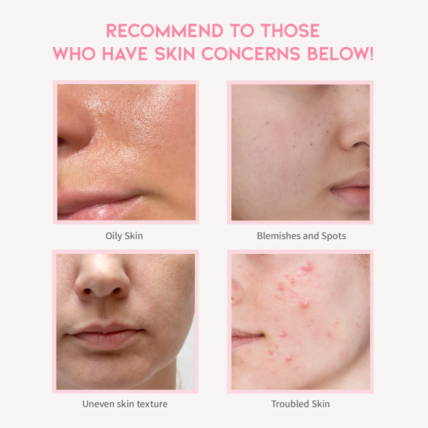 skincare-kbeauty-glowtime-OOTD Beauty Clarifying Niacinamide Serum