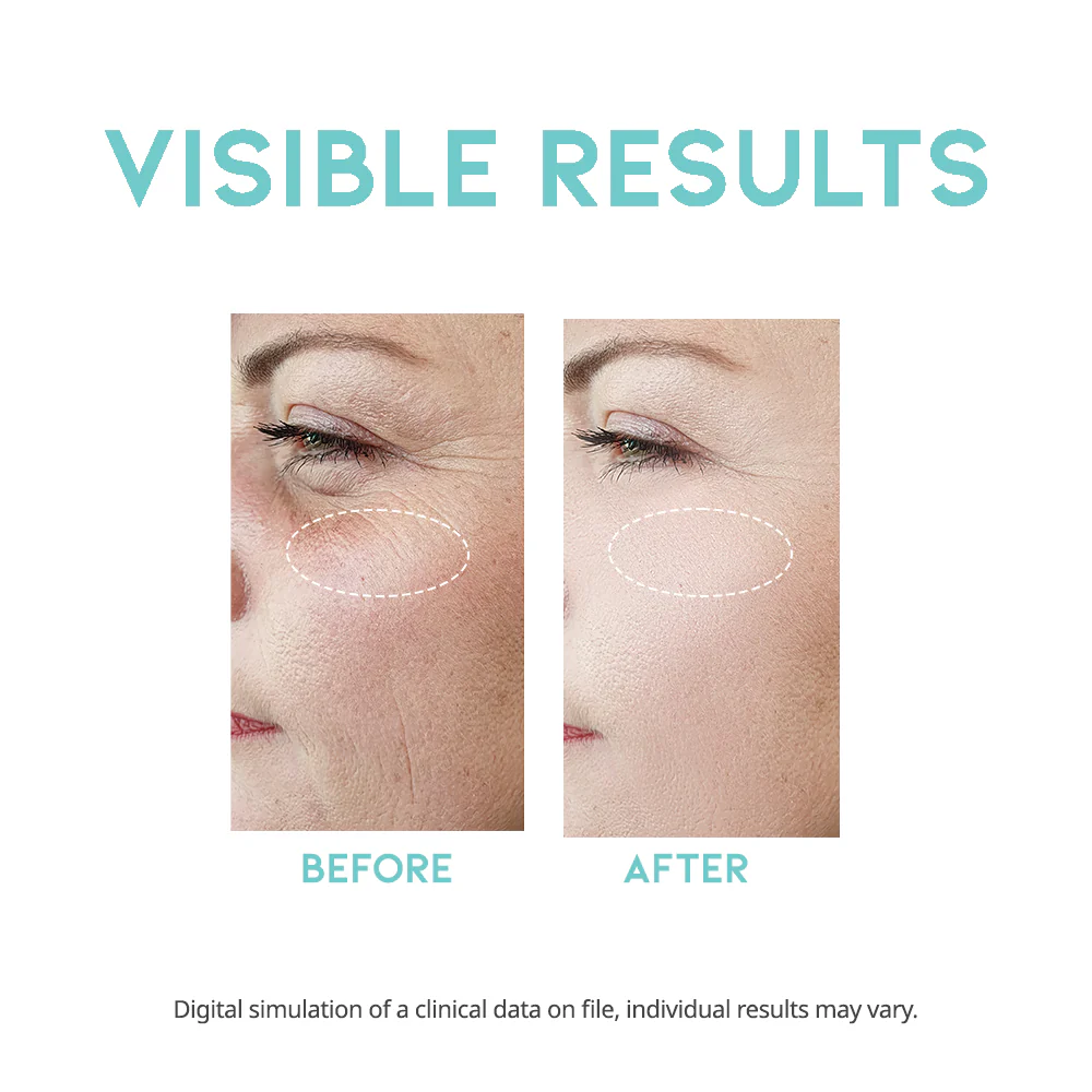 skincare-kbeauty-glowtime-ootd beauty wrinkle lift retinol serum