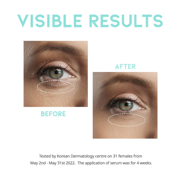 skincare-kbeauty-glowtime-ootd beauty wrinkle lift eye serum