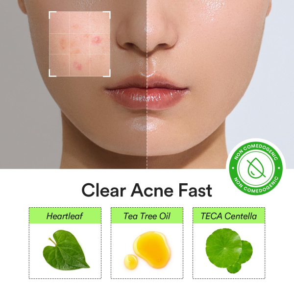skincare-kbeauty-glowtime-abib heartleaf calming spot patch