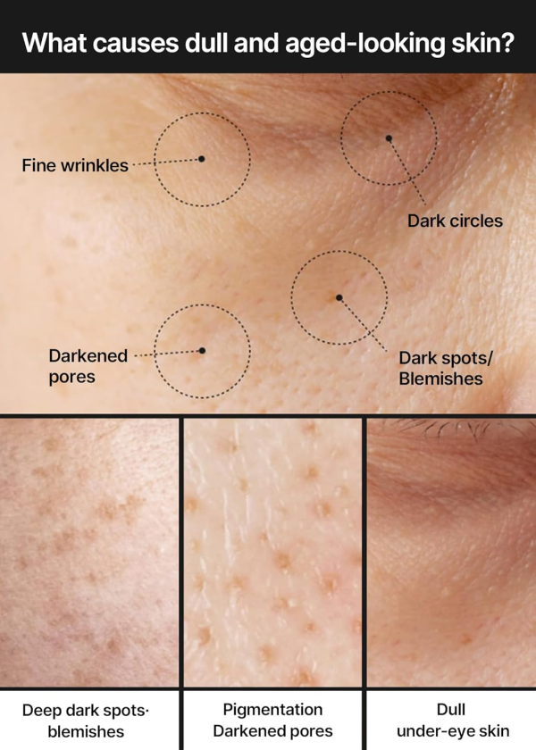 skincare-kbeauty-glowtime-celimax pore and dark spot brightening cream