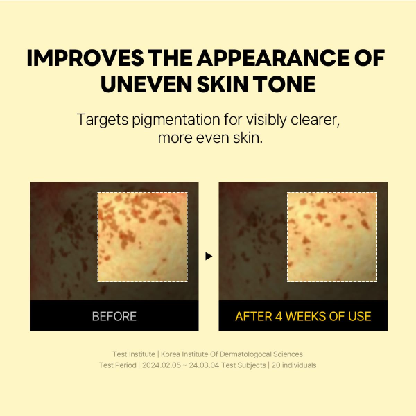 skincare-kbeauty-glowtime-round lab vita niacinamide dark spot serum