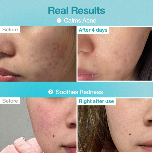 skincare-kbeauty-glowtime-numbuzin 1 pantothenic B5 hyalurnonic active clear mask