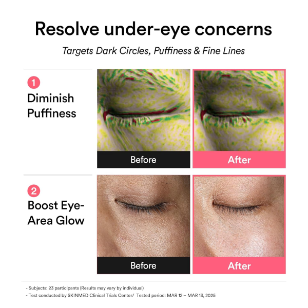 skincare-kbeauty-glowtime-abib pdrn retinal eye patch jelly