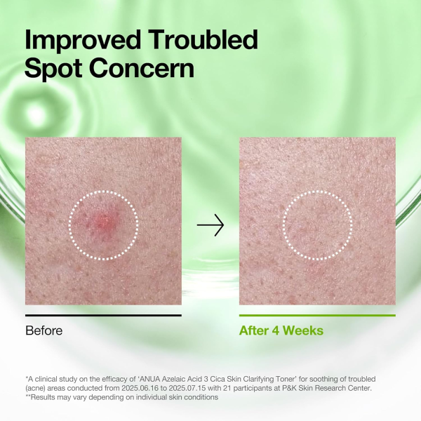 skincare-kbeauty-glowtime-anua azelaic acid 3 cica skin clarifying toner