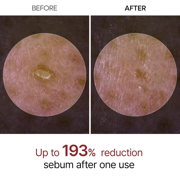 skincare-kbeauty-glowtime-dr melaxin peel shot exfoliatn rice ampoule