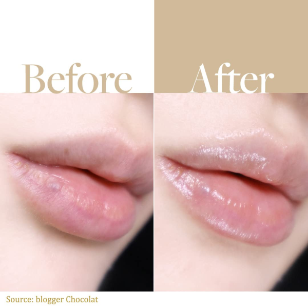 skincare-kbeauty-glowtime-d'alba white truffle nourishing serum lip balm