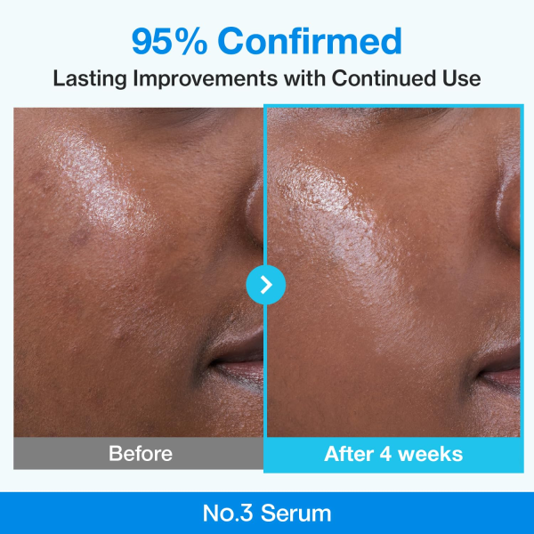 skincare-kbeauty-glowtime-numbuzin 3 bio retinol refining serum
