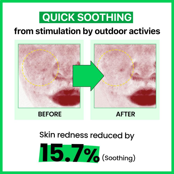 skincare-kbeauty-glowtime-real barrier cica relief rx dacde in serum