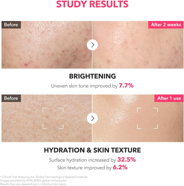 skincare-kbeauty-glowtime-april skin txa niacinamide 99 milky toner