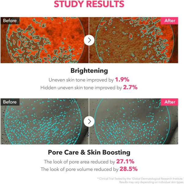 skincare-kbeauty-glowtime-aprilskin txa niacinamide toning shot 99 serum