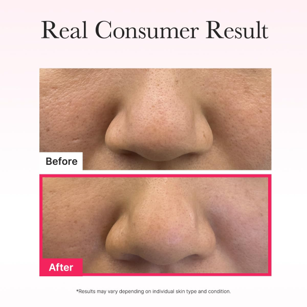 skincare-kbeauty-glowtime-arencia red collagen jello mask