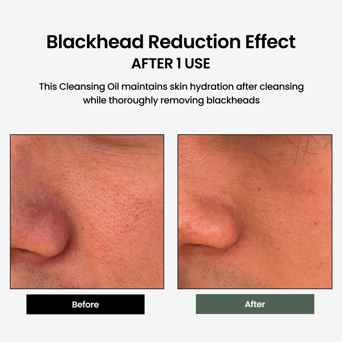 DELPHRY Liposome cleansing oil 5