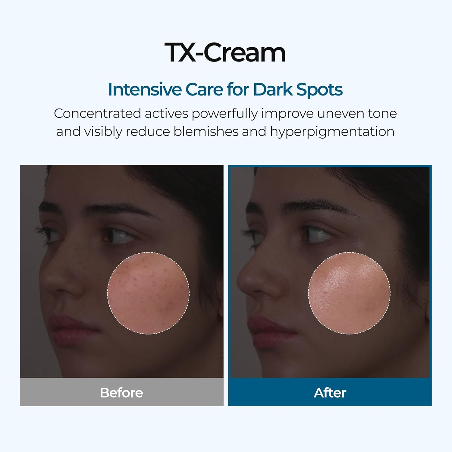 skincare-kbeauty-glowtime-dr melaxin tx cream