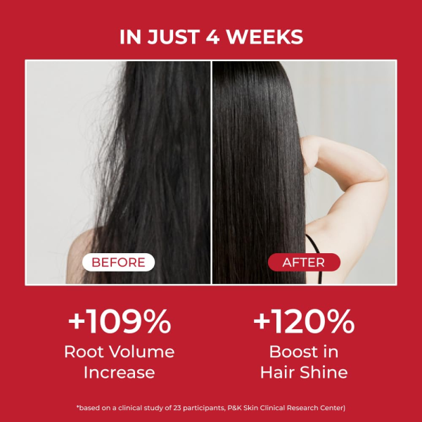 skincare-kbeauty-glowtime-moev annurcatin shampoo