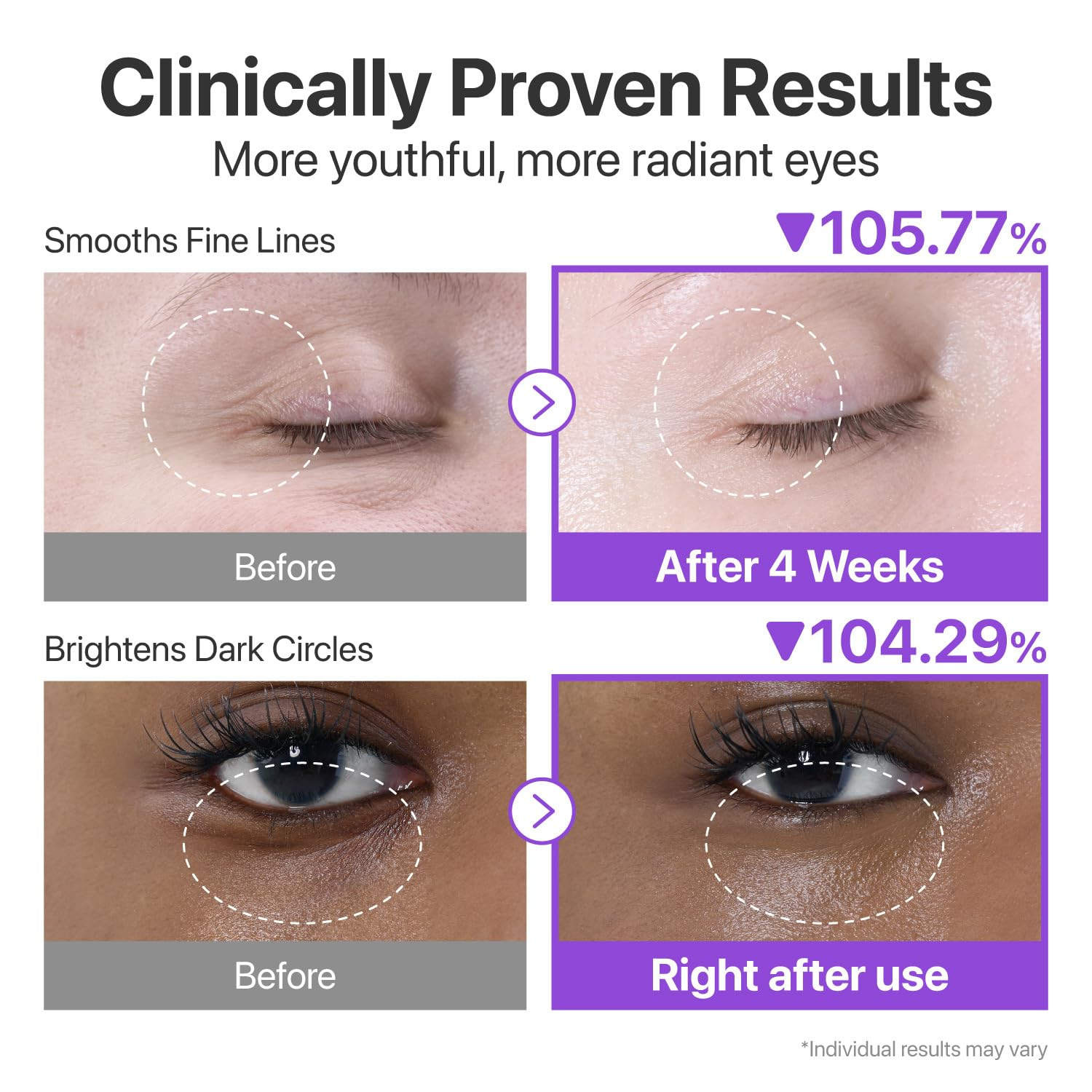 skincare-kbeauty-glowtime-numbuzin 9 retinoil volumetox eye crream