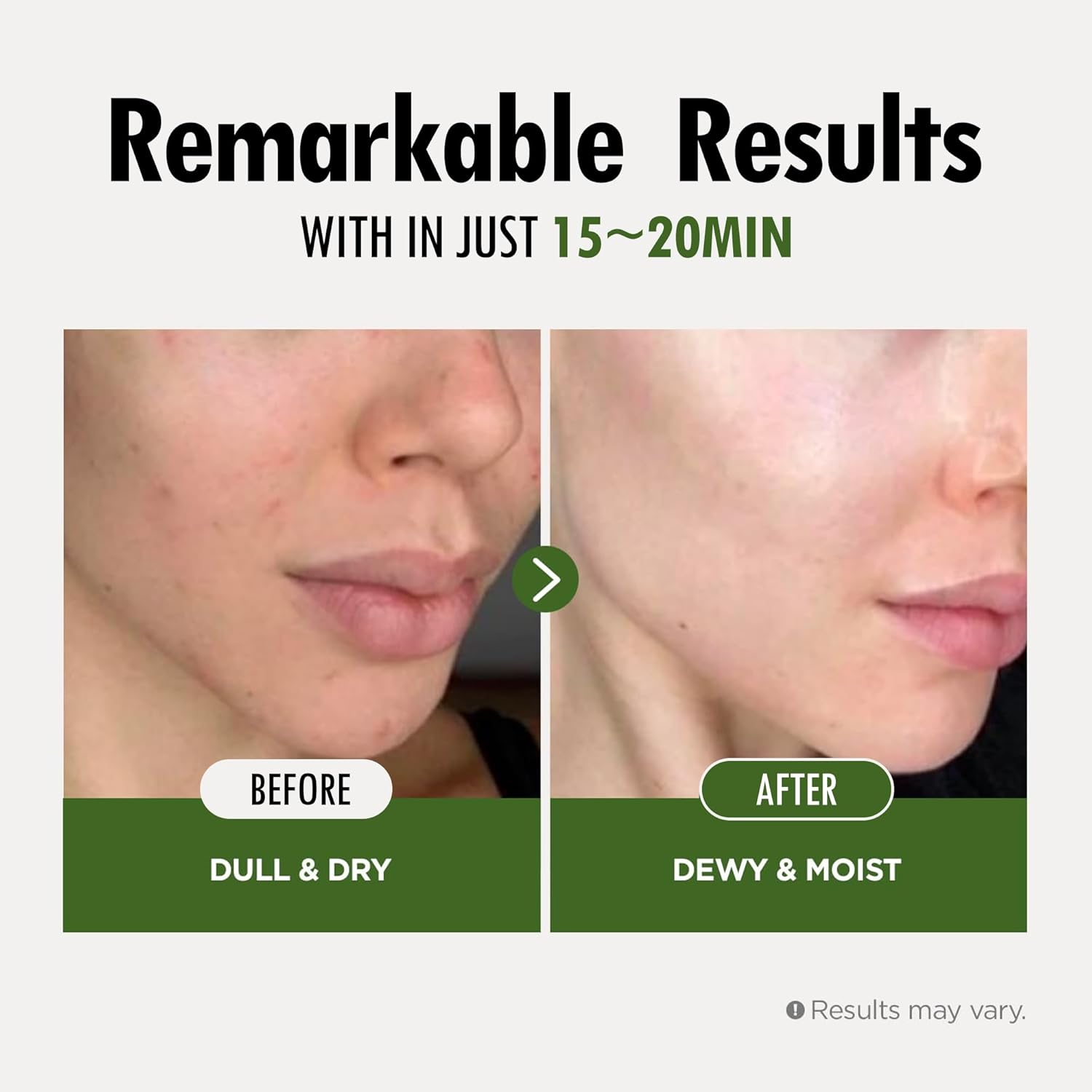 FARM SKIN Fresh Food Facial Sheet Mask 6 skincare-kbeauty-glowtime-farm skin fresh food facial sheet mask