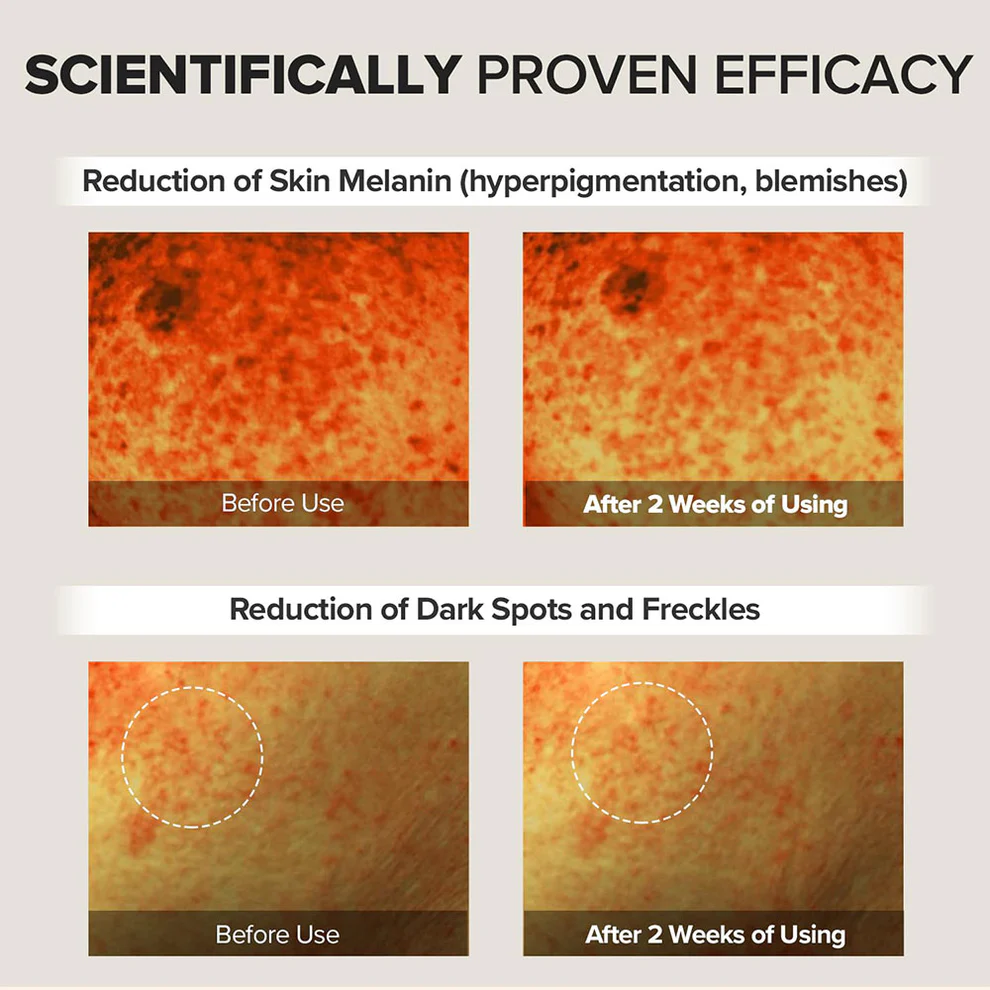 MARY AND MAY Tranexamic and Glutathione Eye Cream Set 3 skincare-kbeauty-glowtime-mary and may tranexamic and glutathione eye cream set