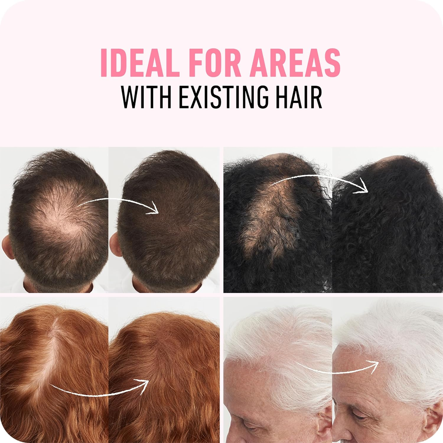 BOLDIFY Hair Fibers medium Brown 3 skincare-kbeauty-glowtime-boldify hair fibers