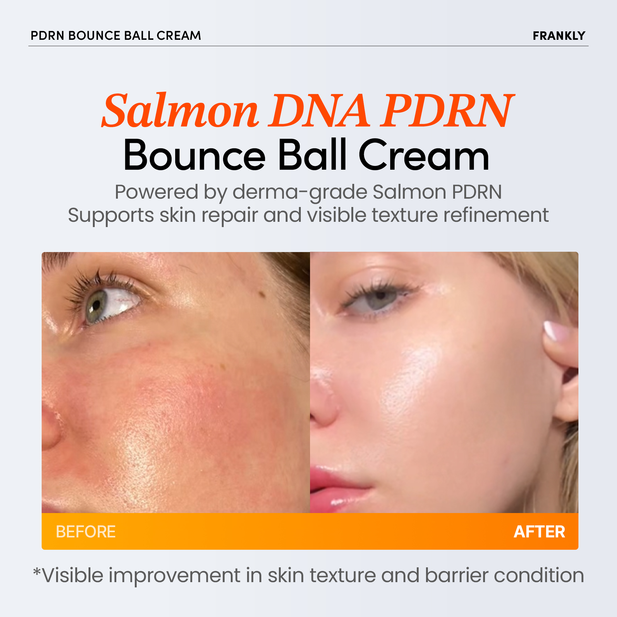 skincare-kbeauty-glowtime-frankly pdrn bounce ball cream